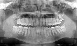 Ukryte problemy zostają prześwietlone