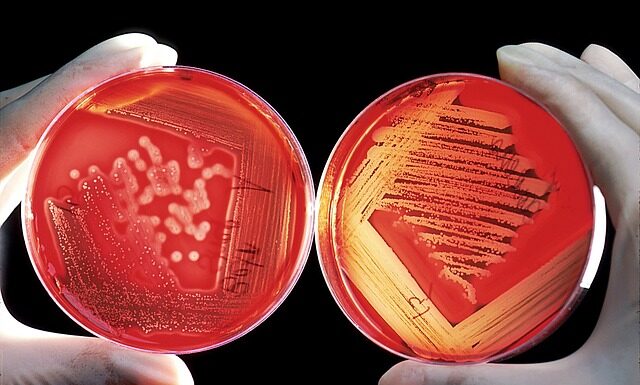 Jak usunąć resztki kleju z taśmy? Jak usunąć resztki kleju z taśmy?