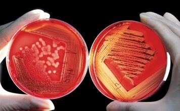 Jaki rozpuszczalnik do kleju?